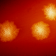 Colonia de Clostridium difficile en una placa de petri.
